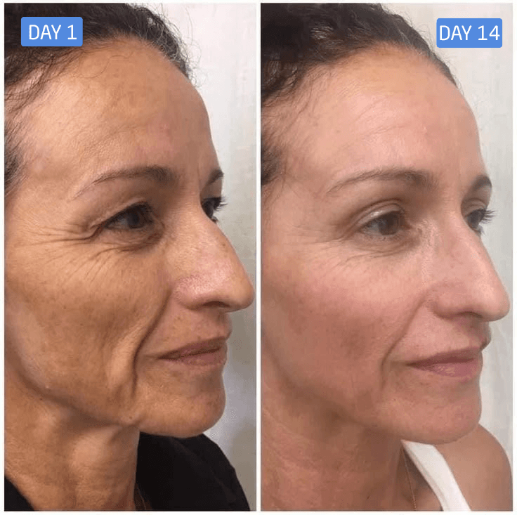 Elizabeth R. result photo