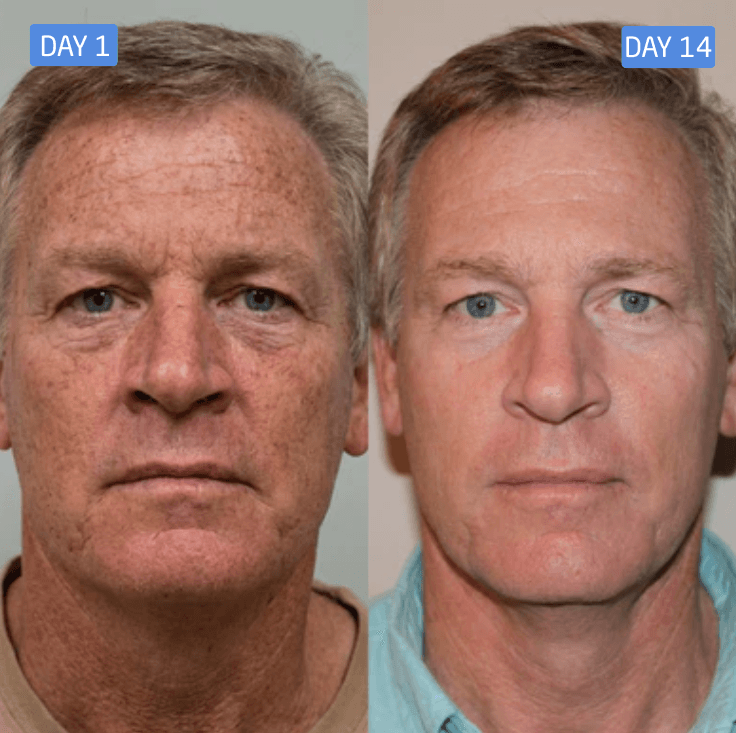 Frank J. result photo